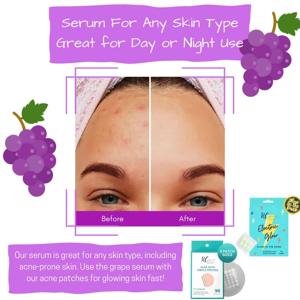 Hyaluronic Acid & Vitamin C Brightening Serum — Hydrate, Glow & Fade Dark Spots